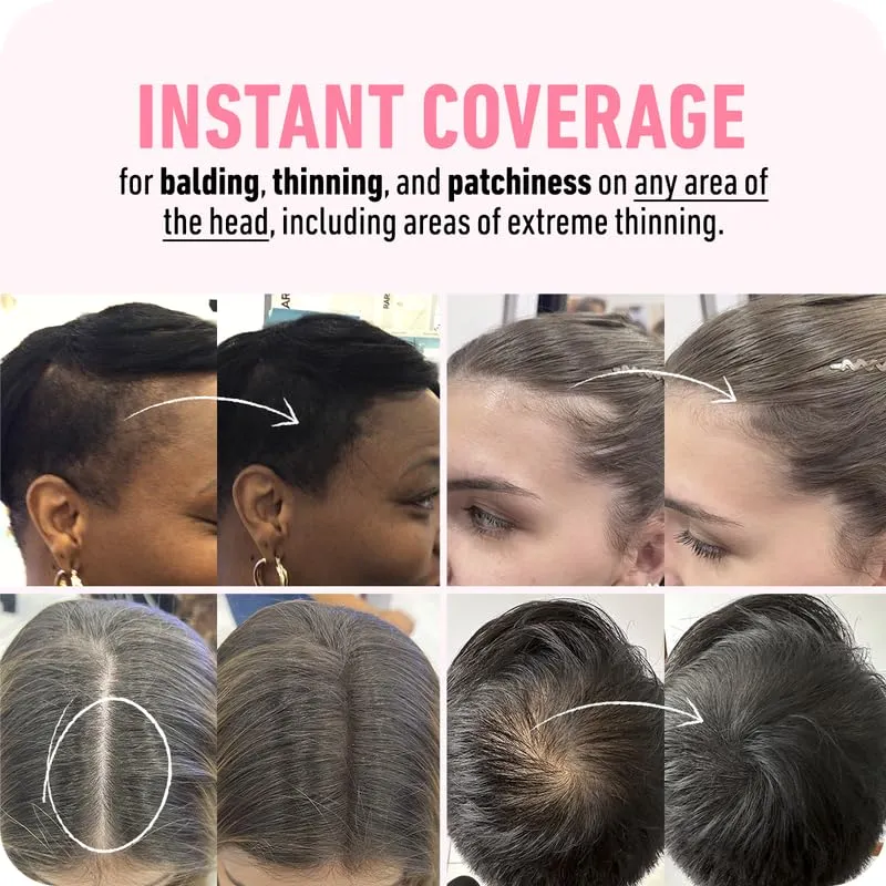 BOLDIFY Hairline Powder - Root Touch Up & Hair Loss Cover Up, Instant Gray Coverage 48-Hour Stain-Proof Hair Color Powder for Women & Men, Hair Fibers and Hair Topper Alternative (Medium Blonde)