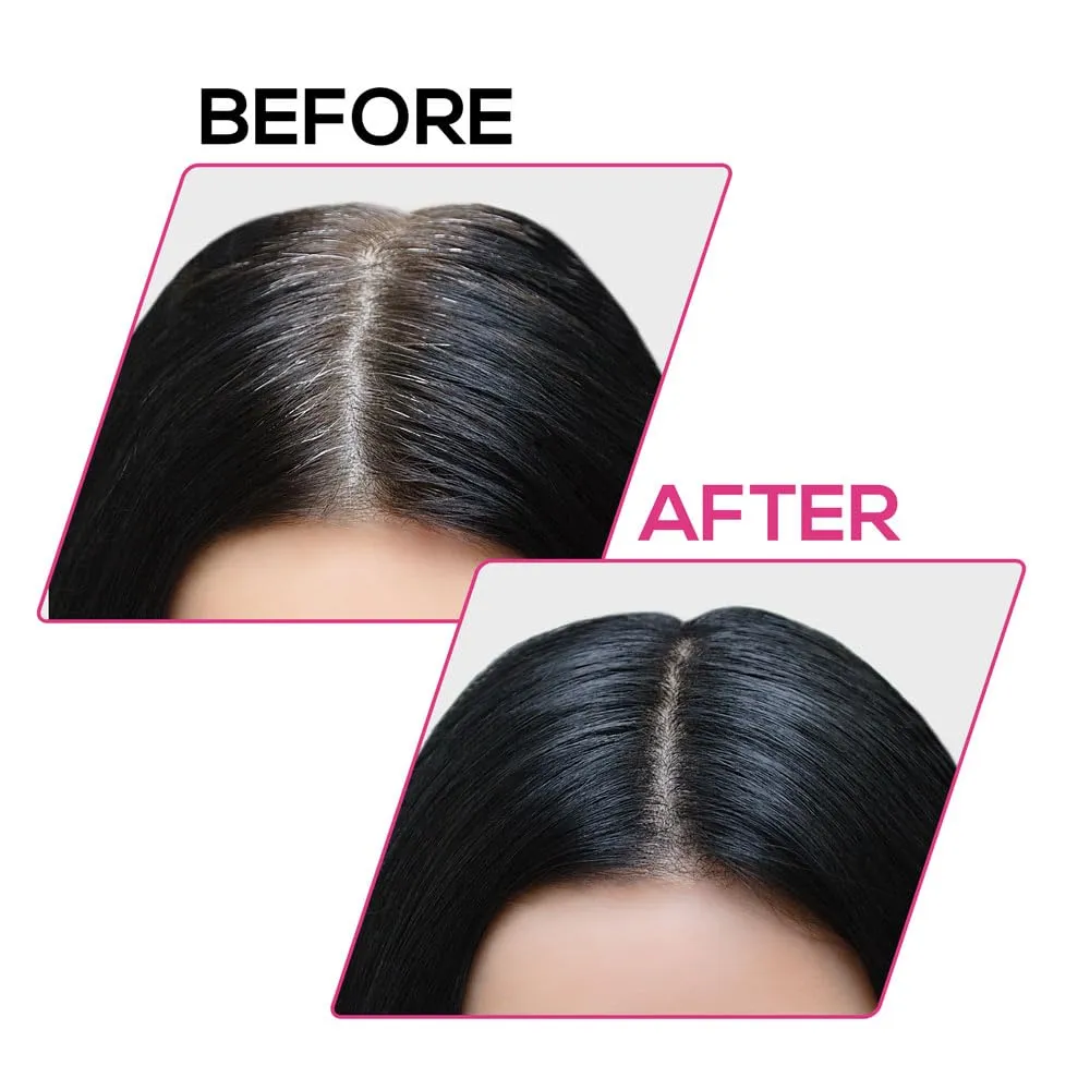 RENEE Cover-Up Hair Powder- Black, Cover Grey Roots & Bald Spots Instantly, Highly Pigmented, Fuller and Denser, Long-Lasting & Matte Finish, Flawless Application, 4gm