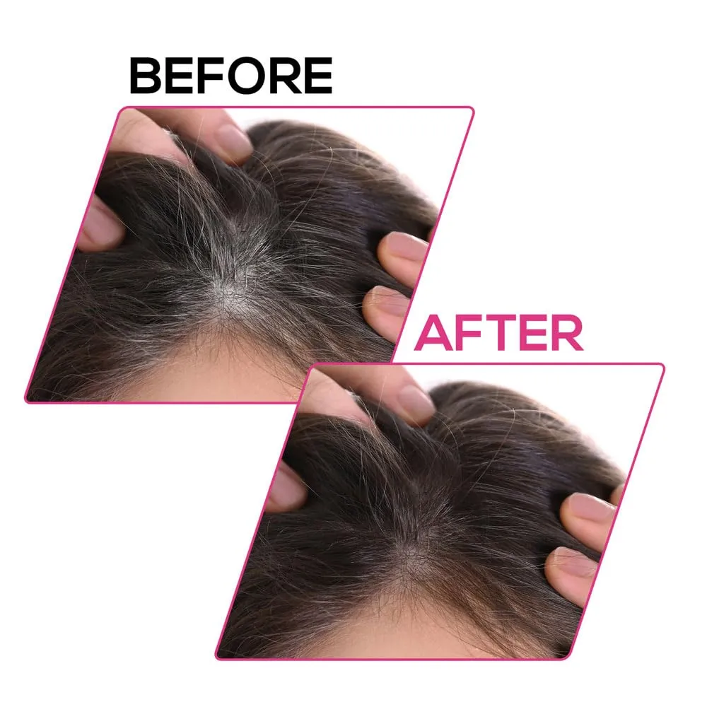 RENEE Cover-Up Hair Powder- Brown, Cover Grey Roots & Bald Spots Instantly, Highly Pigmented, Fuller and Denser, Long-Lasting & Matte Finish, Flawless Application, 4gm